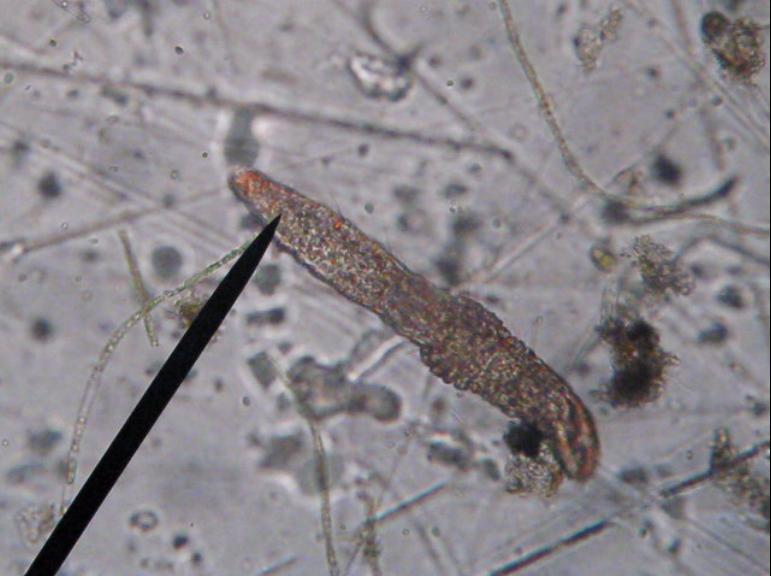 Anche io Aeolosoma Hemprichi